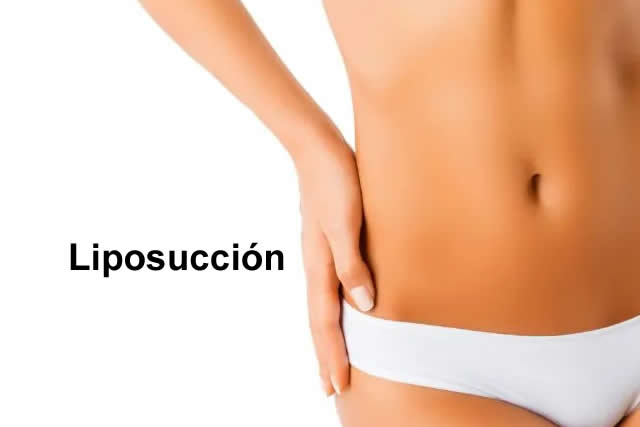 LIPO VÁSER HD
